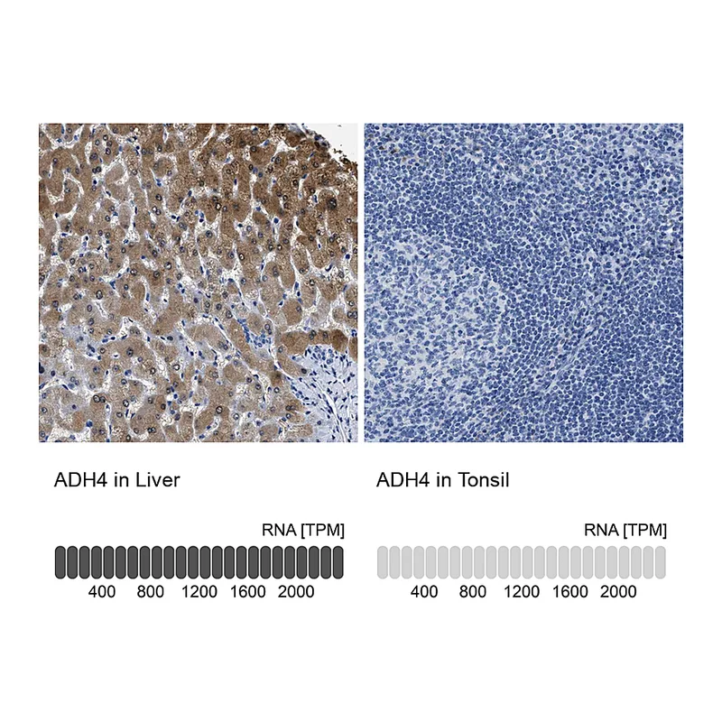 Atlas Antibodies Anti-ADH4 Antibody