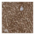 Atlas Antibodies Anti-ADI1 Antibody