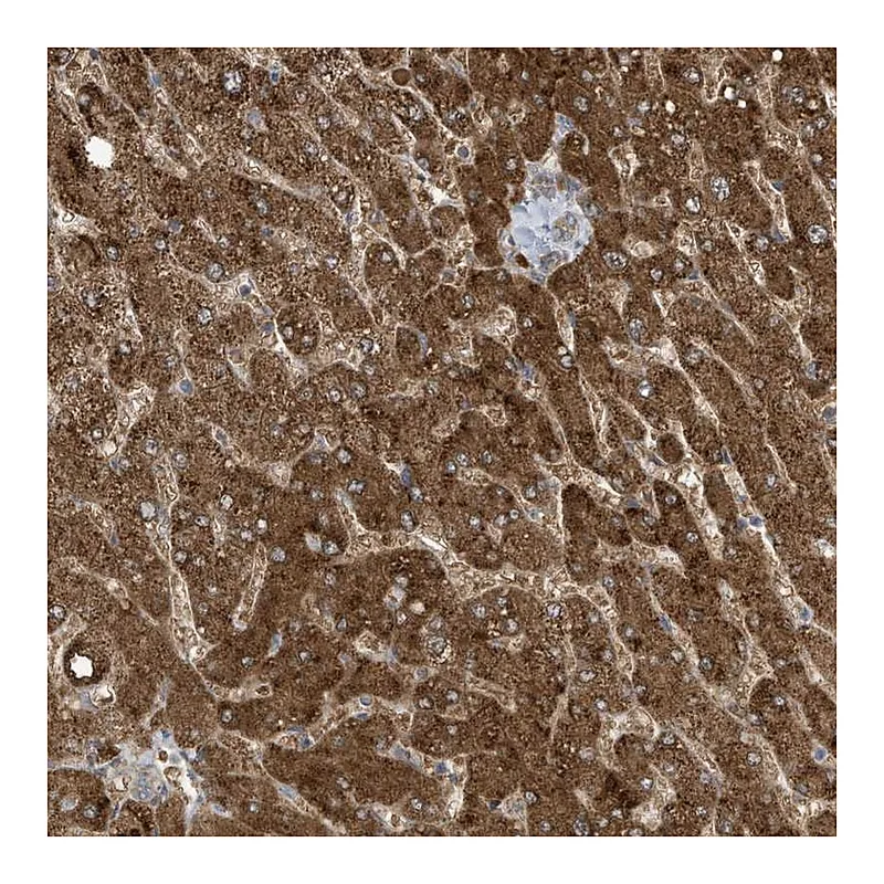 Atlas Antibodies Anti-ADI1 Antibody