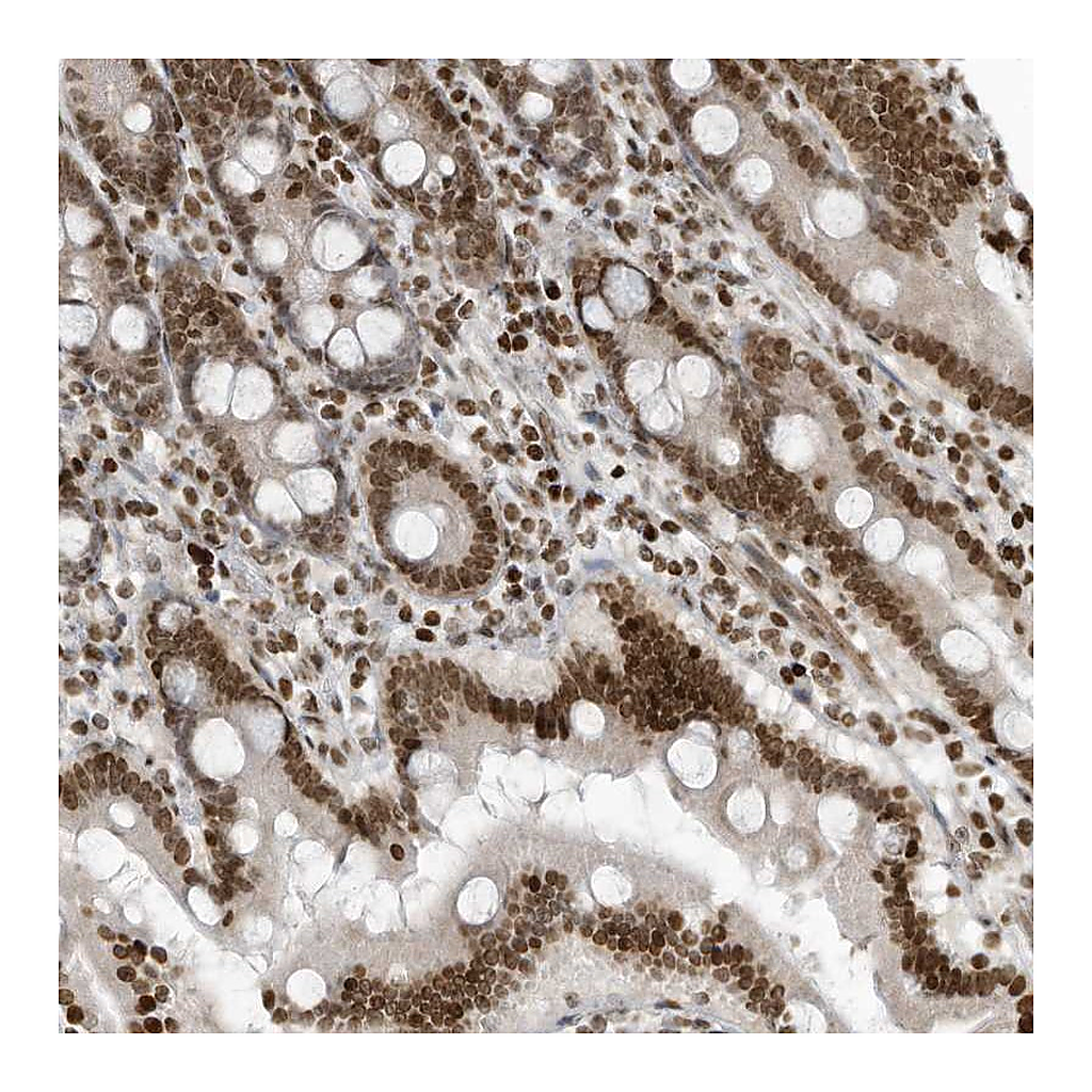 Atlas Antibodies Anti-ADI1 Antibody