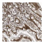 Atlas Antibodies Anti-ADI1 Antibody