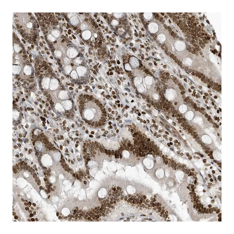 Atlas Antibodies Anti-ADI1 Antibody