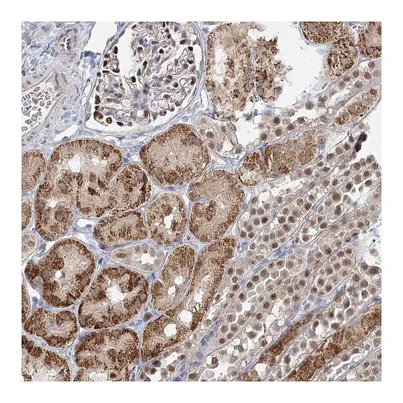 Atlas Antibodies Anti-ADK Antibody