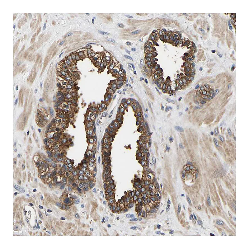 Atlas Antibodies Anti-LRBA Antibody