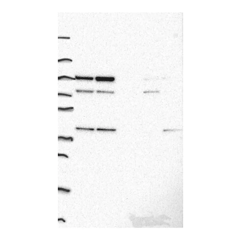 Atlas Antibodies Anti-ADK Antibody