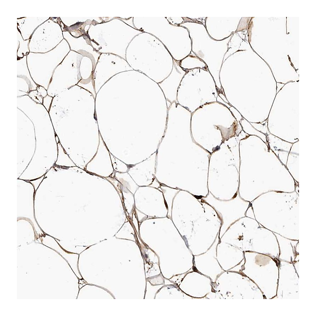 Atlas Antibodies Anti-ADIRF Antibody