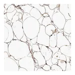 Atlas Antibodies Anti-ADIRF Antibody