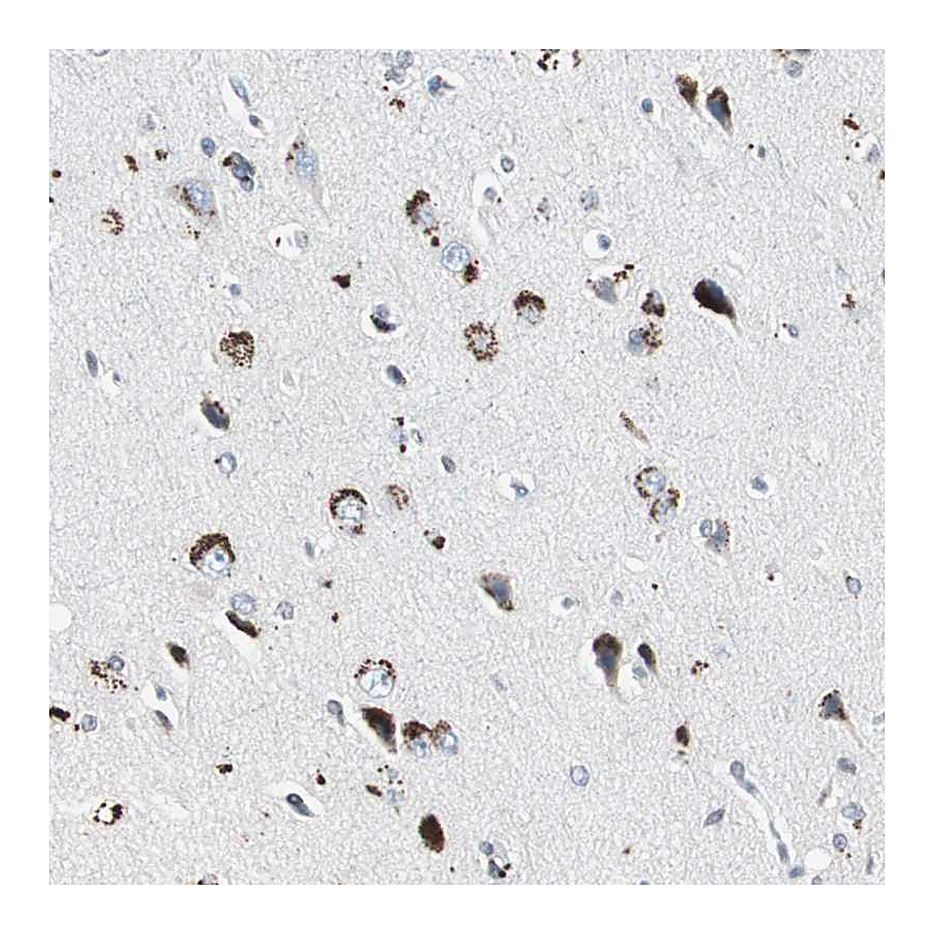 Atlas Antibodies Anti-ADNP2 Antibody