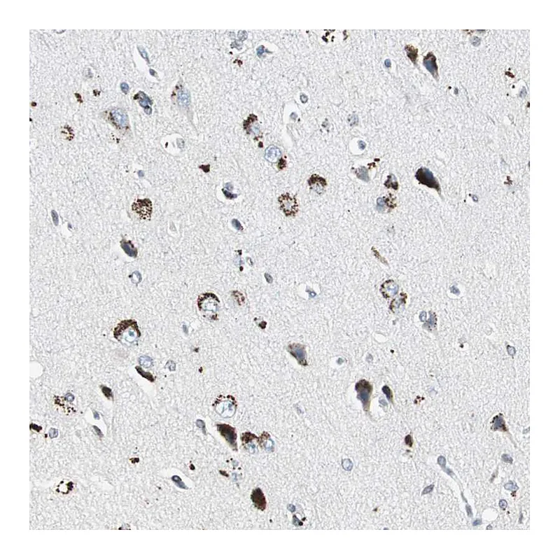 Atlas Antibodies Anti-ADNP2 Antibody