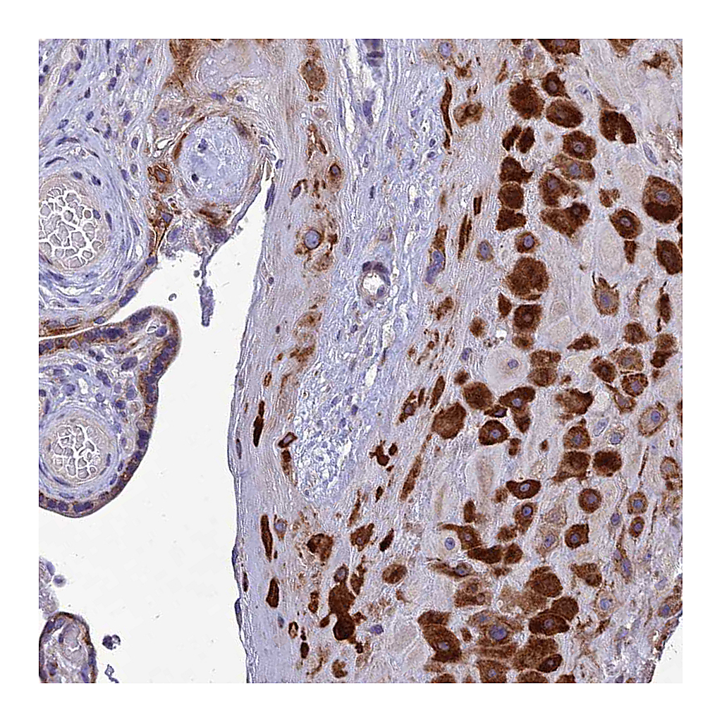 Atlas Antibodies Anti-ADIPOR2 Antibody