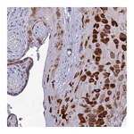 Atlas Antibodies Anti-ADIPOR2 Antibody