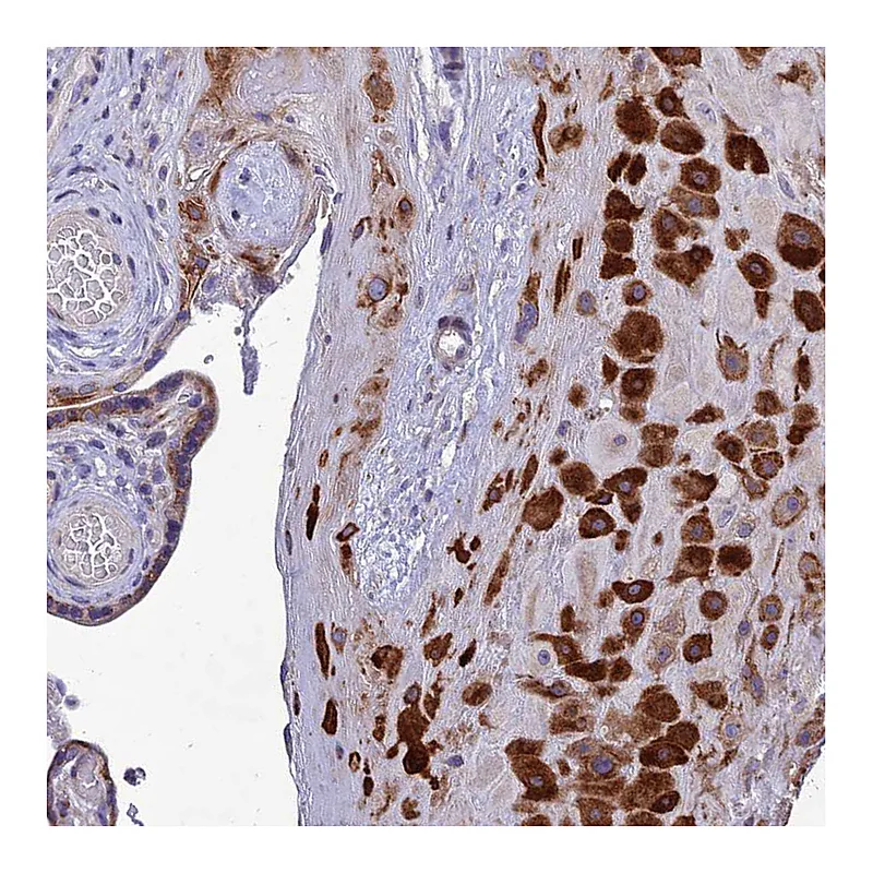Atlas Antibodies Anti-ADIPOR2 Antibody