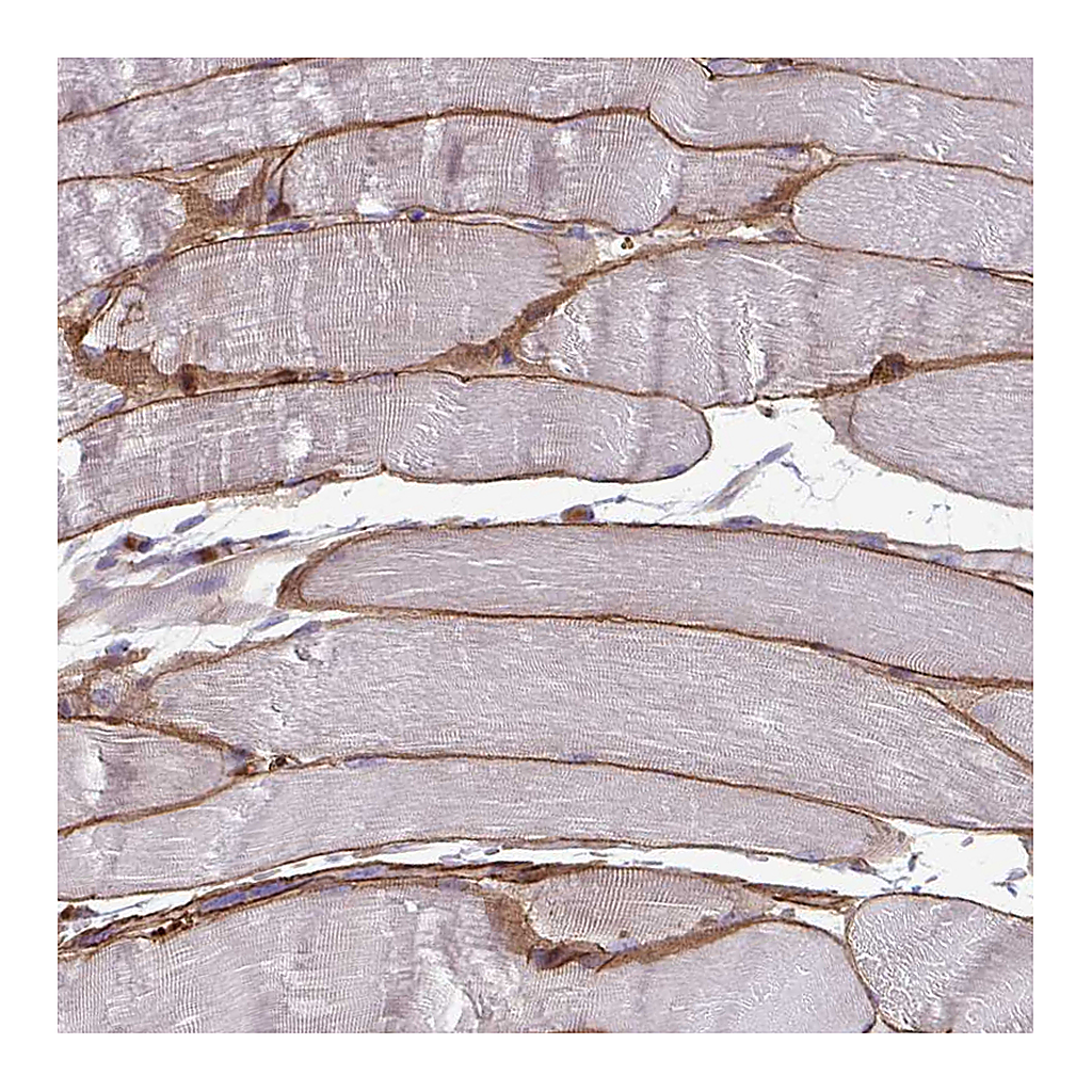Atlas Antibodies Anti-ADIPOQ Antibody