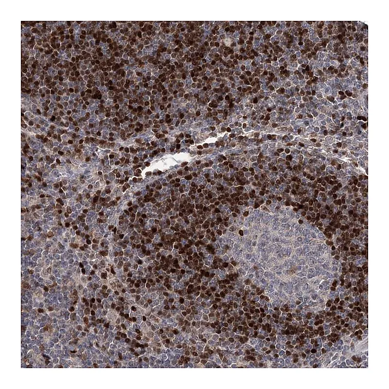 Atlas Antibodies Anti-ADK Antibody