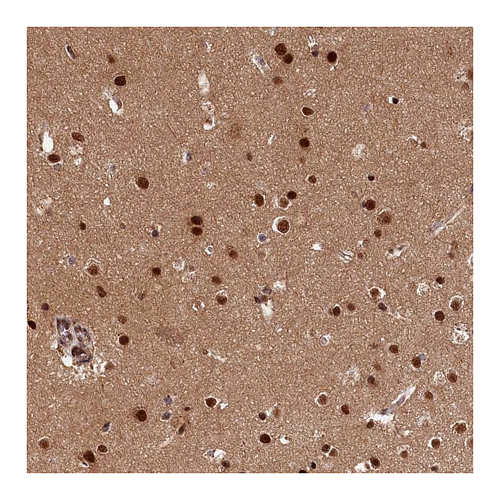 Atlas Antibodies Anti-ADIG Antibody