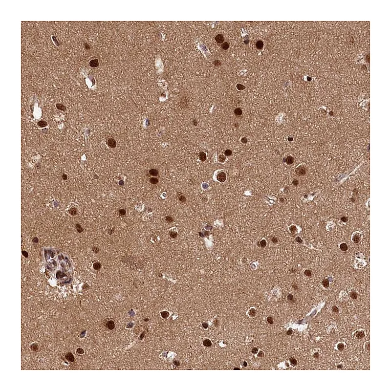 Atlas Antibodies Anti-ADIG Antibody