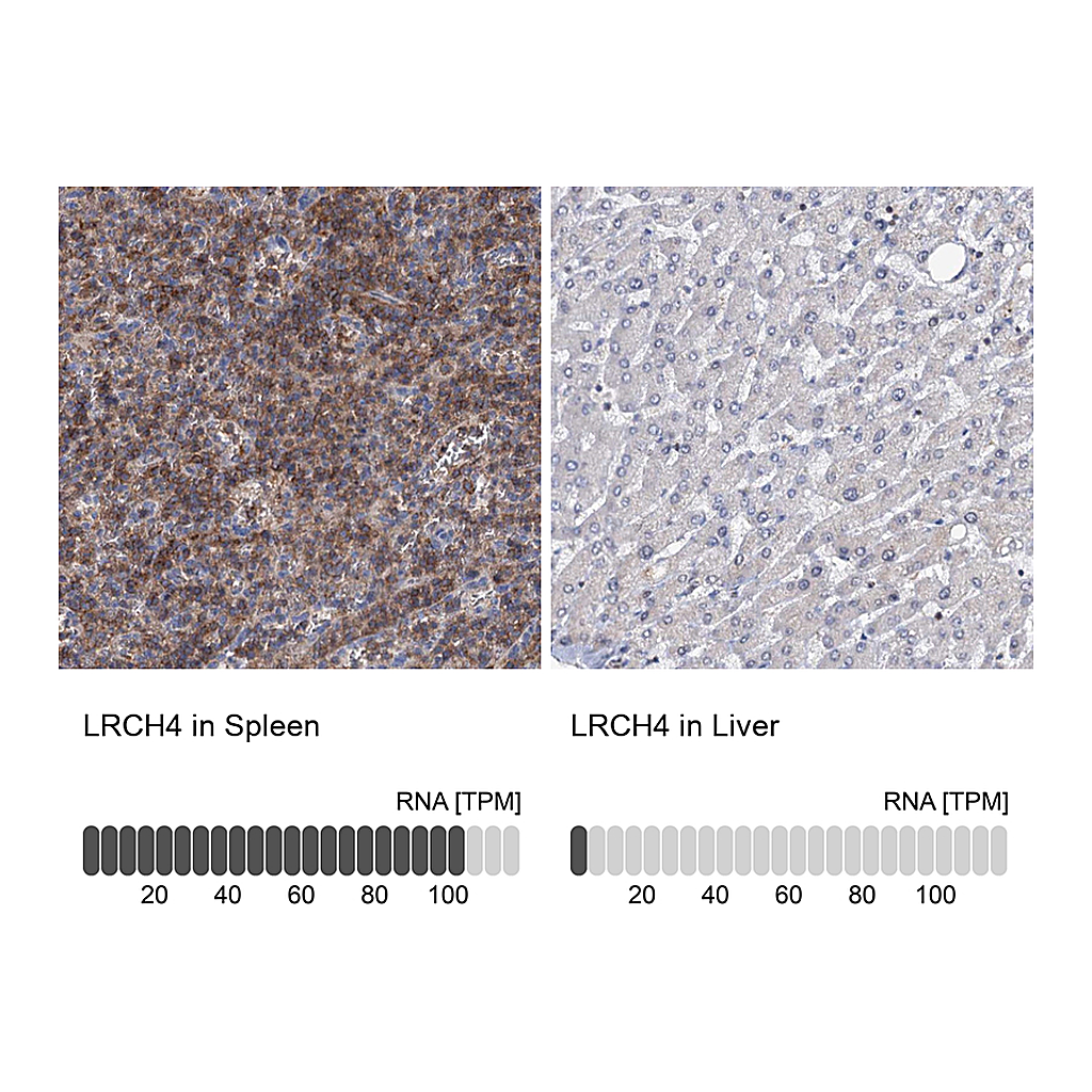 Atlas Antibodies Anti-LRCH4 Antibody