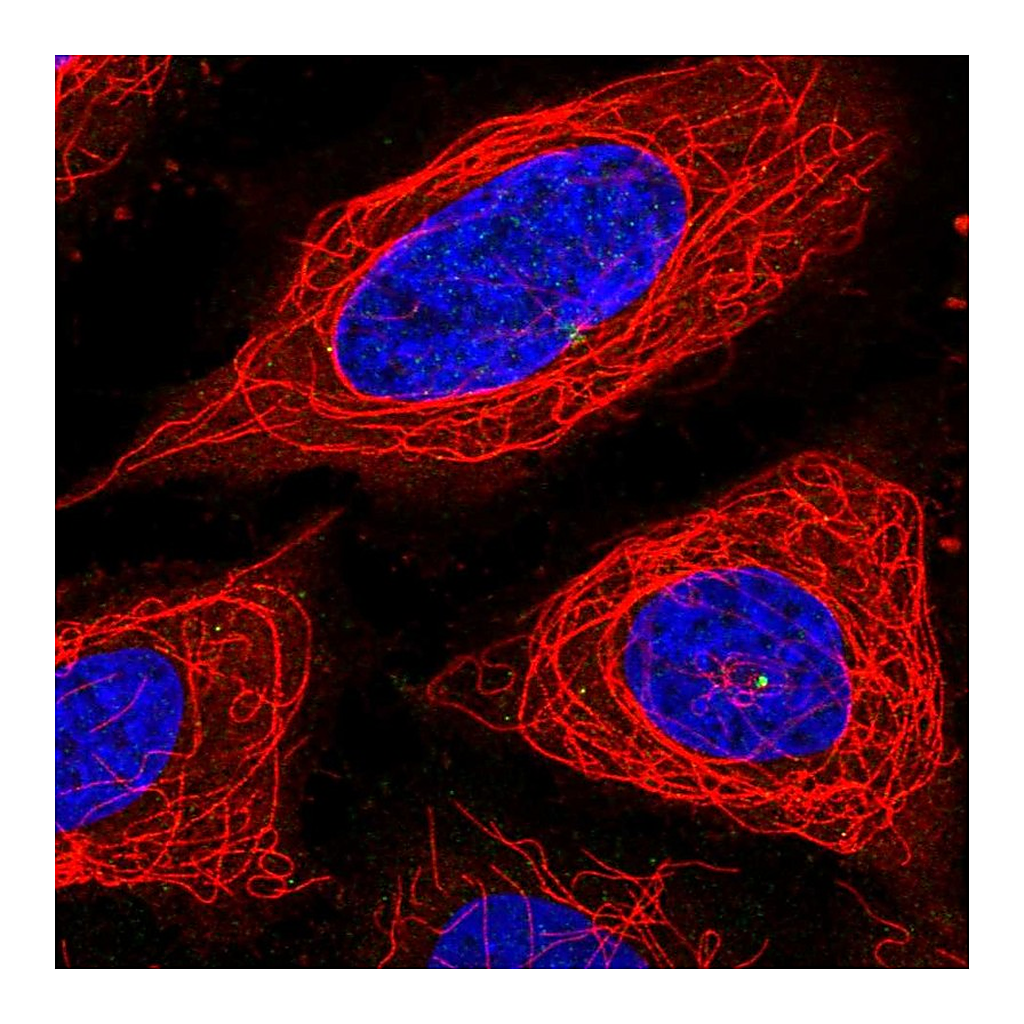 Atlas Antibodies Anti-ADPGK Antibody