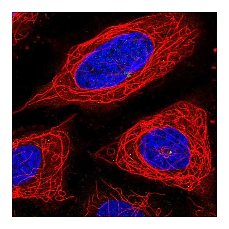 Atlas Antibodies Anti-ADPGK Antibody