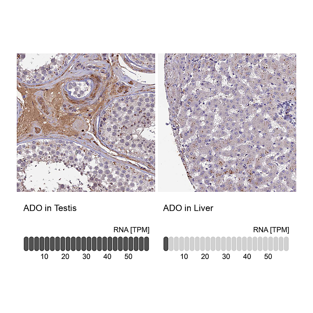 Atlas Antibodies Anti-ADO Antibody