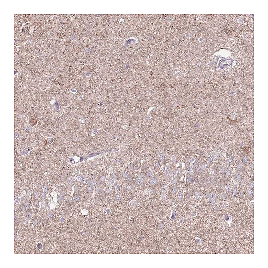 Atlas Antibodies Anti-LRFN3 Antibody