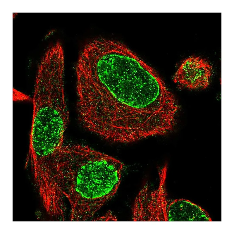 Atlas Antibodies Anti-ADPRH Antibody