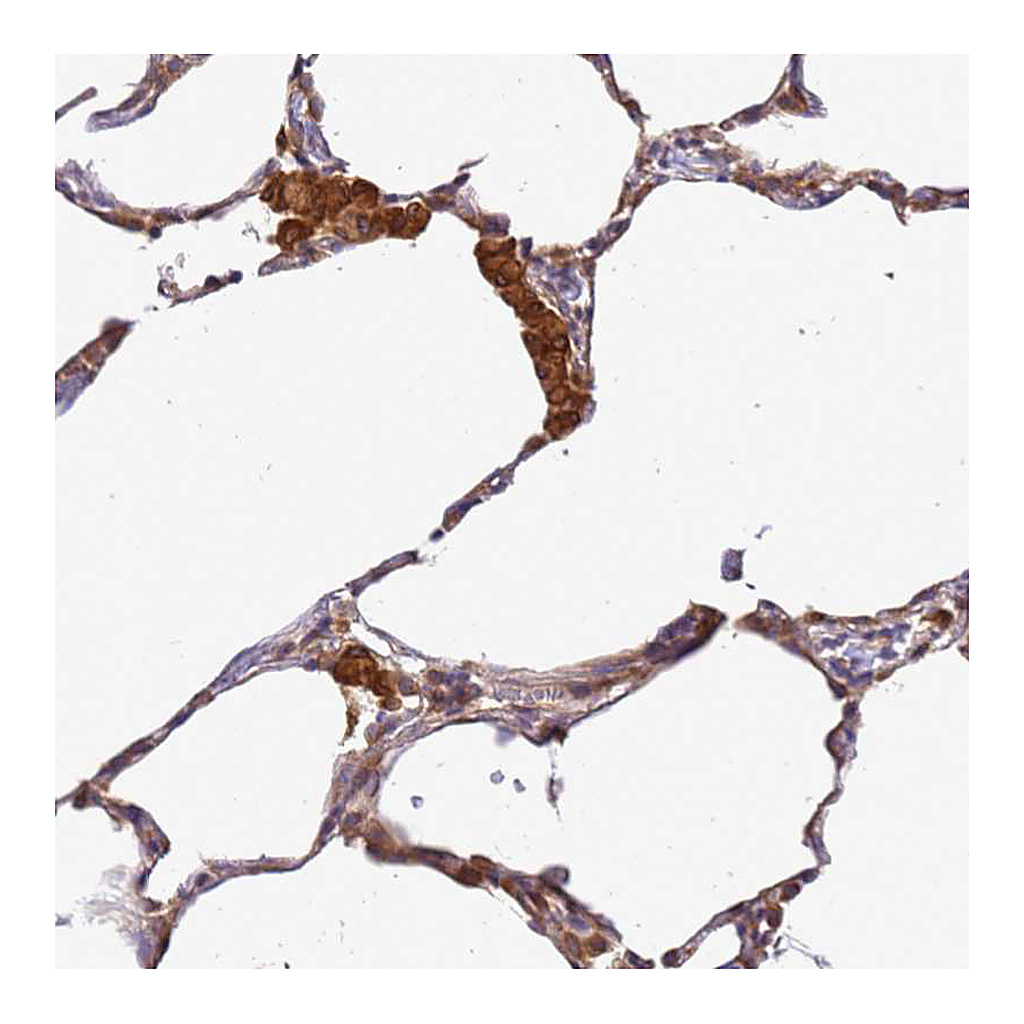 Atlas Antibodies Anti-ADPGK Antibody