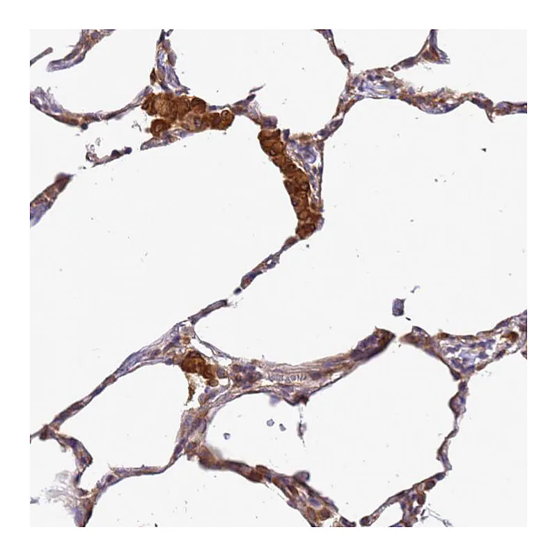 Atlas Antibodies Anti-ADPGK Antibody