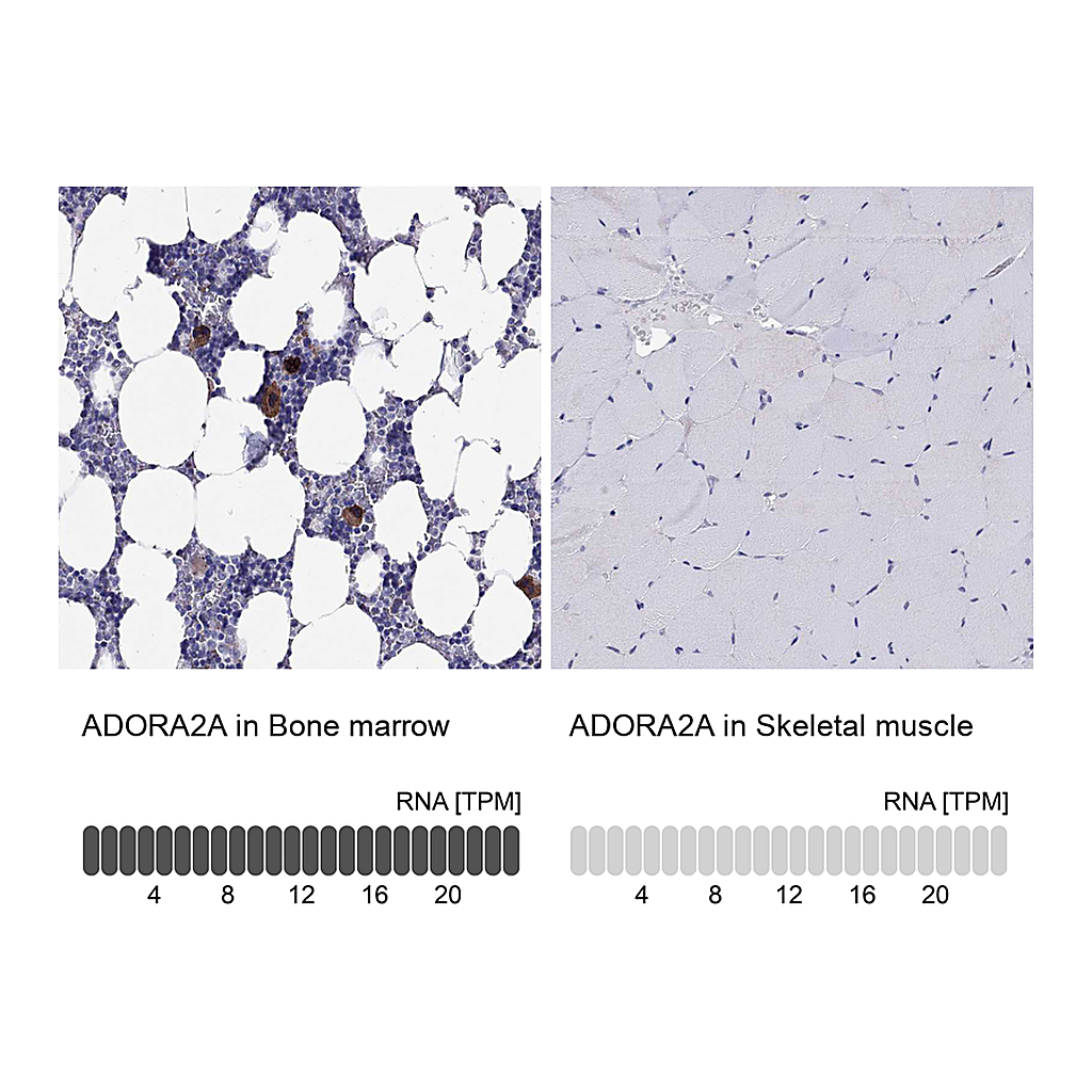 Atlas Antibodies Anti-ADORA2A Antibody