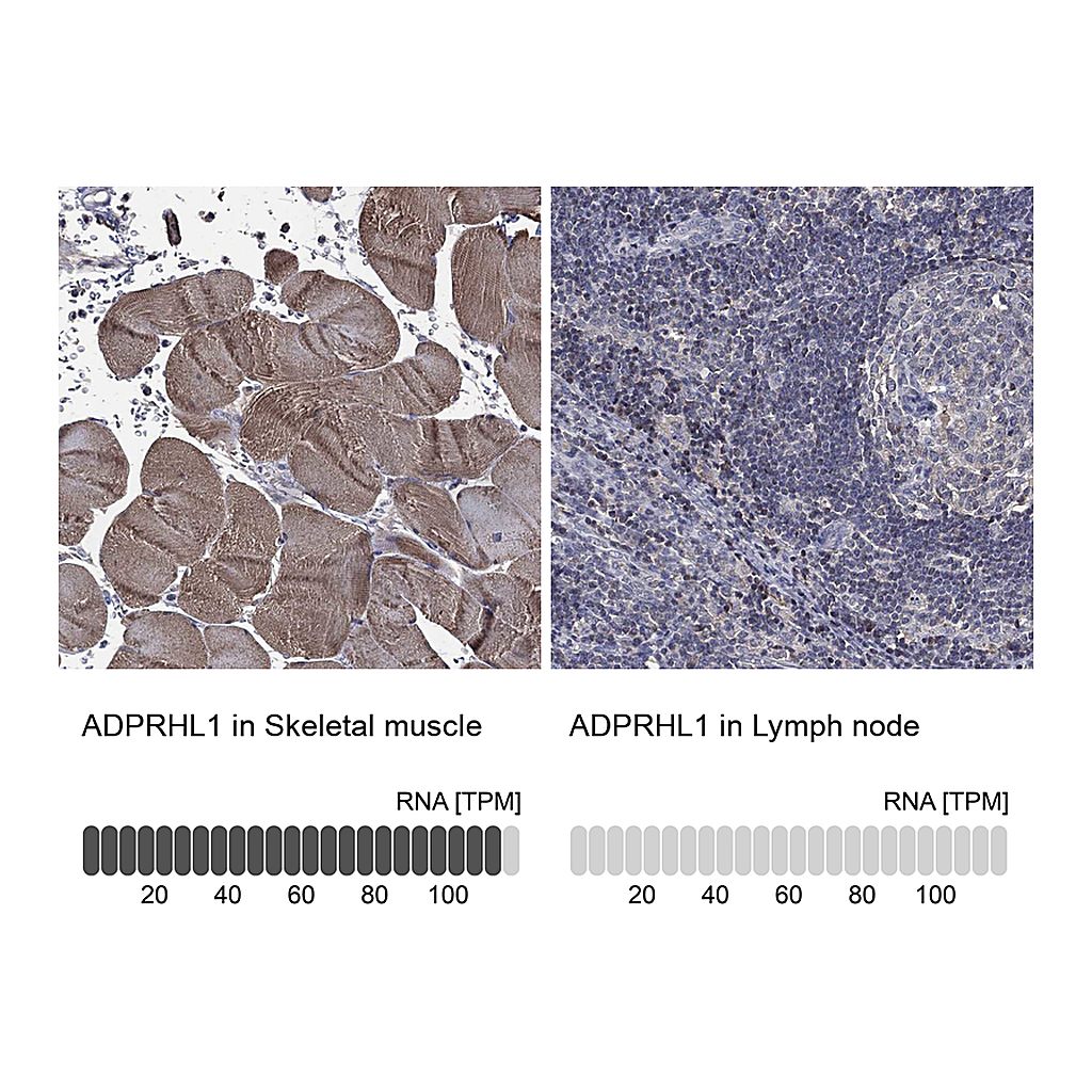 Atlas Antibodies Anti-ADPRHL1 Antibody