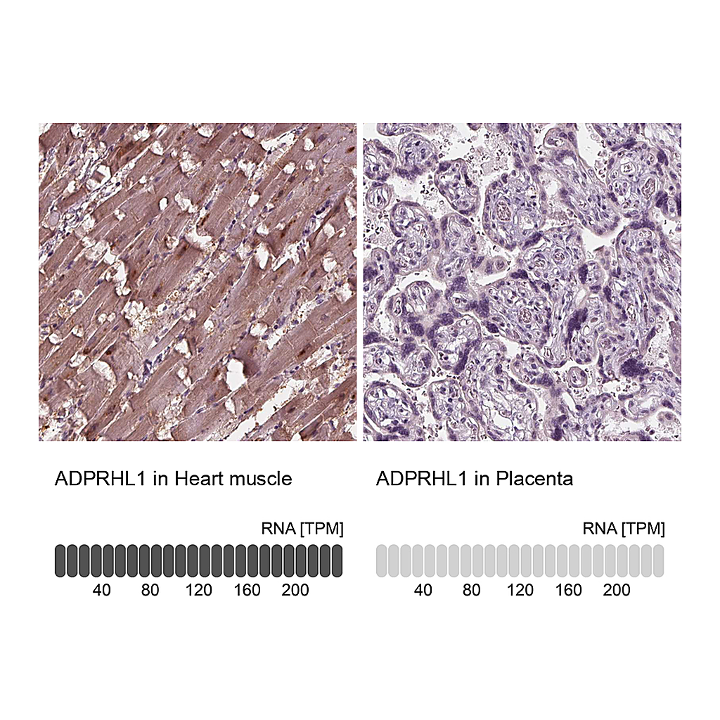Atlas Antibodies Anti-ADPRHL1 Antibody