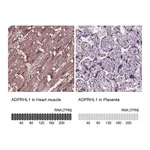 Atlas Antibodies Anti-ADPRHL1 Antibody