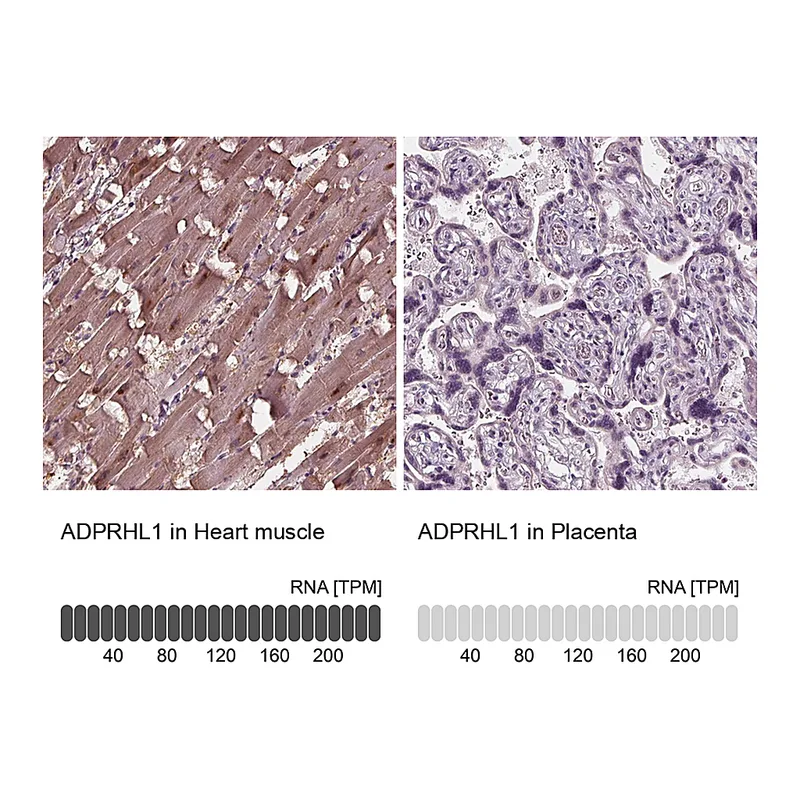 Atlas Antibodies Anti-ADPRHL1 Antibody