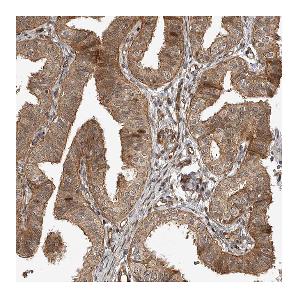 Atlas Antibodies Anti-ADPRHL2 Antibody