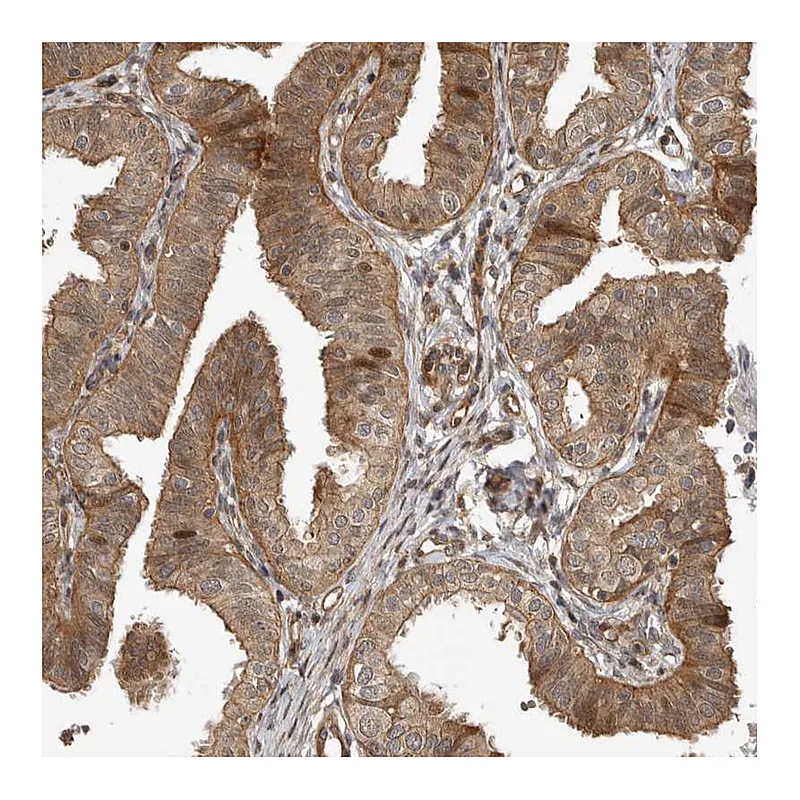 Atlas Antibodies Anti-ADPRHL2 Antibody