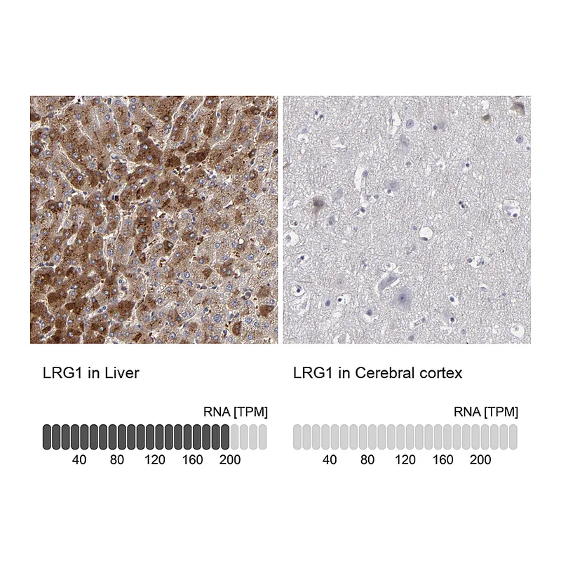 Atlas Antibodies Anti-LRG1 Antibody