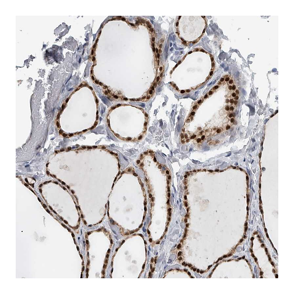Atlas Antibodies Anti-ADPRM Antibody