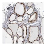 Atlas Antibodies Anti-ADPRM Antibody