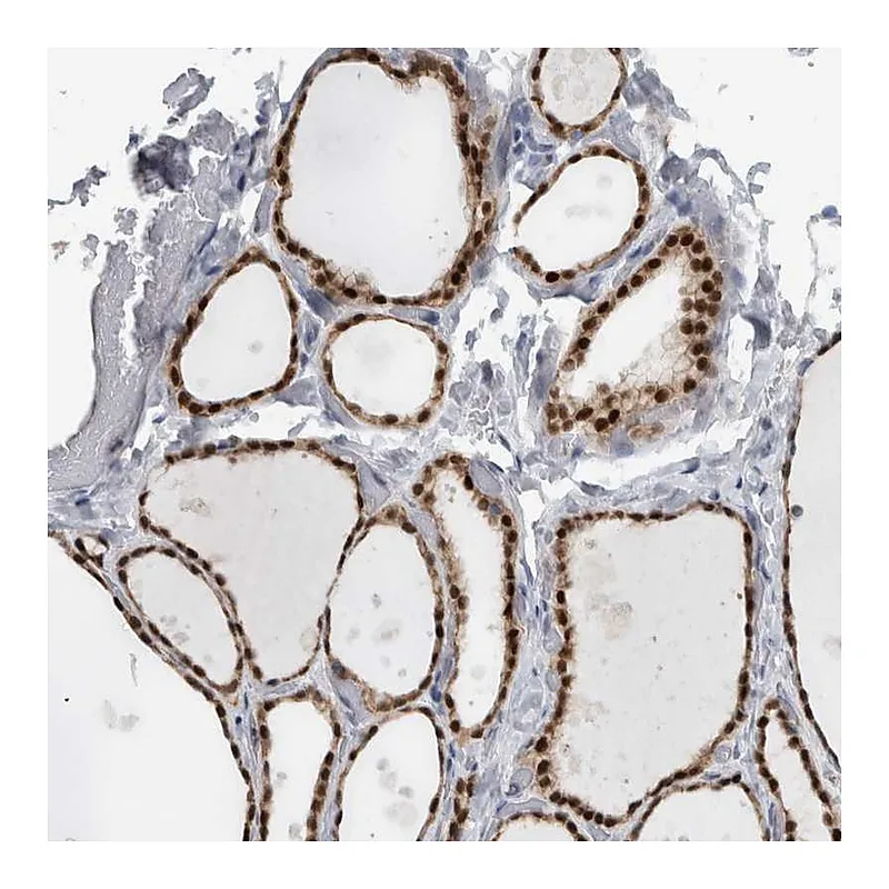 Atlas Antibodies Anti-ADPRM Antibody