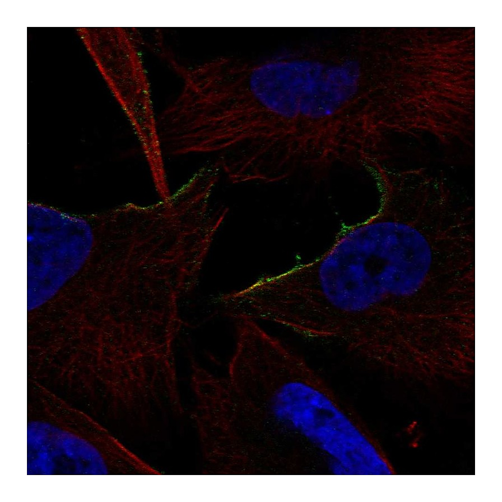 Atlas Antibodies Anti-ADRA1B Antibody