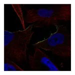 Atlas Antibodies Anti-ADRA1B Antibody