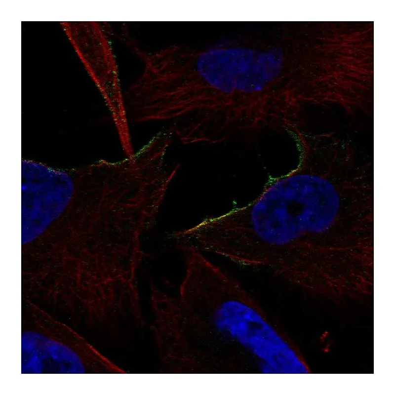 Atlas Antibodies Anti-ADRA1B Antibody