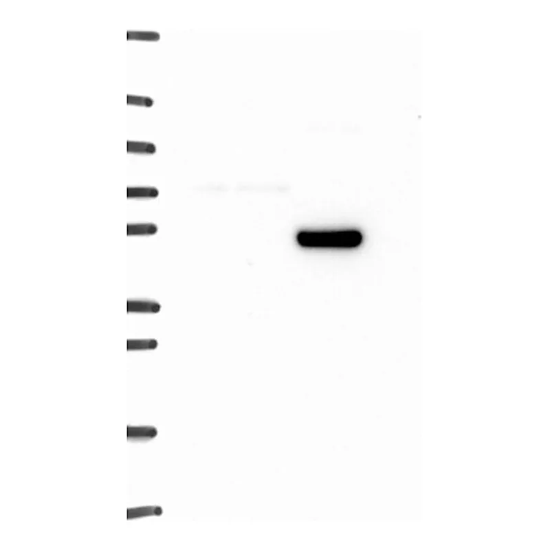 Atlas Antibodies Anti-ADRA1A Antibody