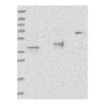 Atlas Antibodies Anti-ADPRS Antibody