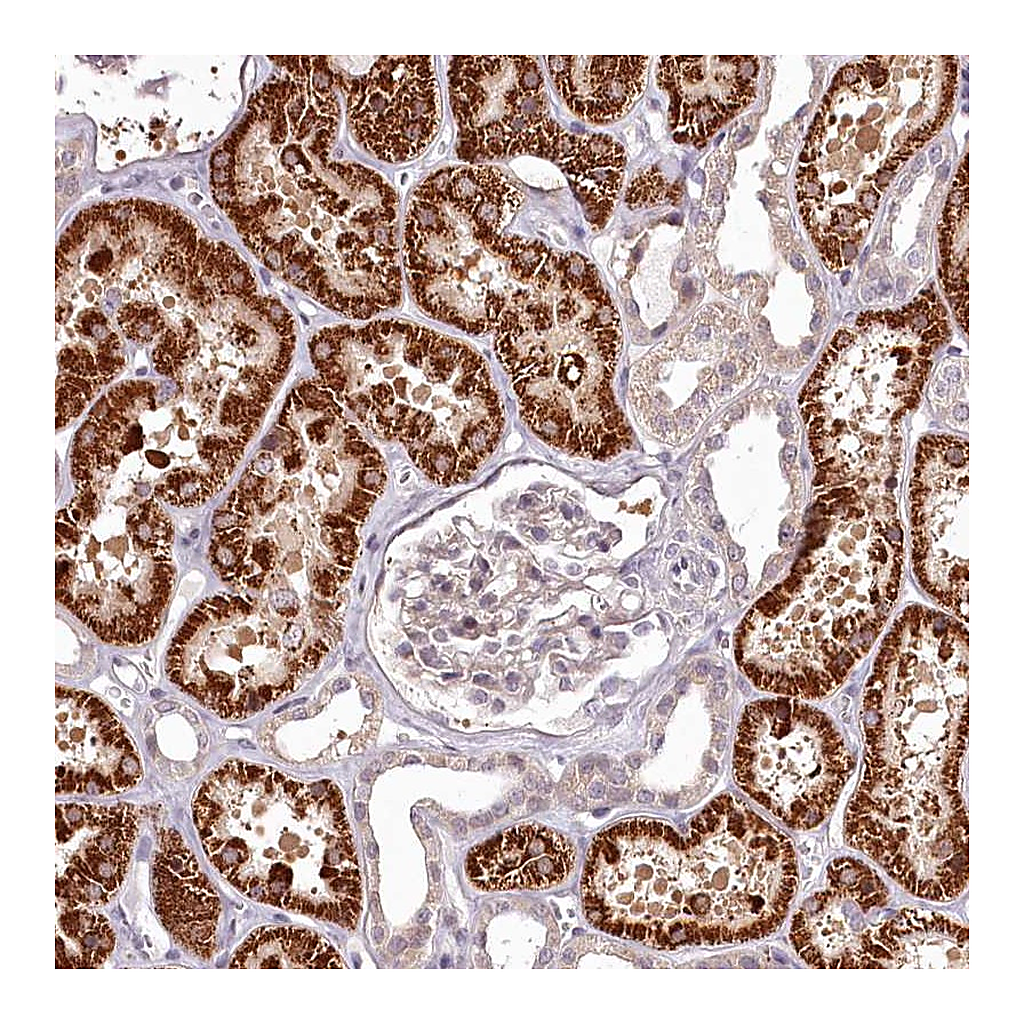 Atlas Antibodies Anti-ADRA1D Antibody