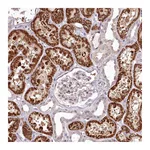 Atlas Antibodies Anti-ADRA1D Antibody