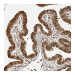 Atlas Antibodies Anti-ADPRHL2 Antibody