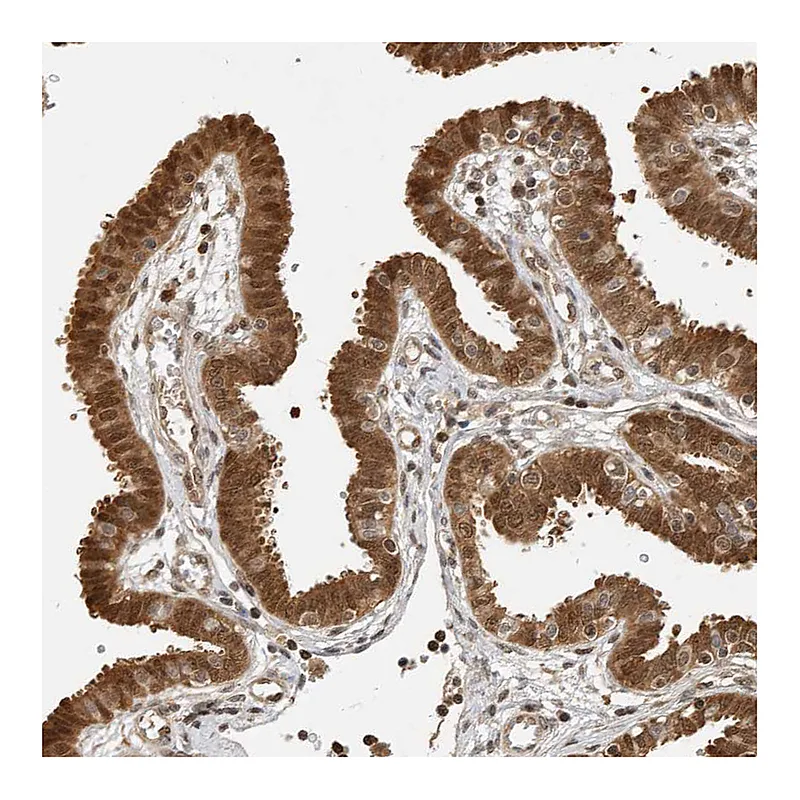 Atlas Antibodies Anti-ADPRHL2 Antibody
