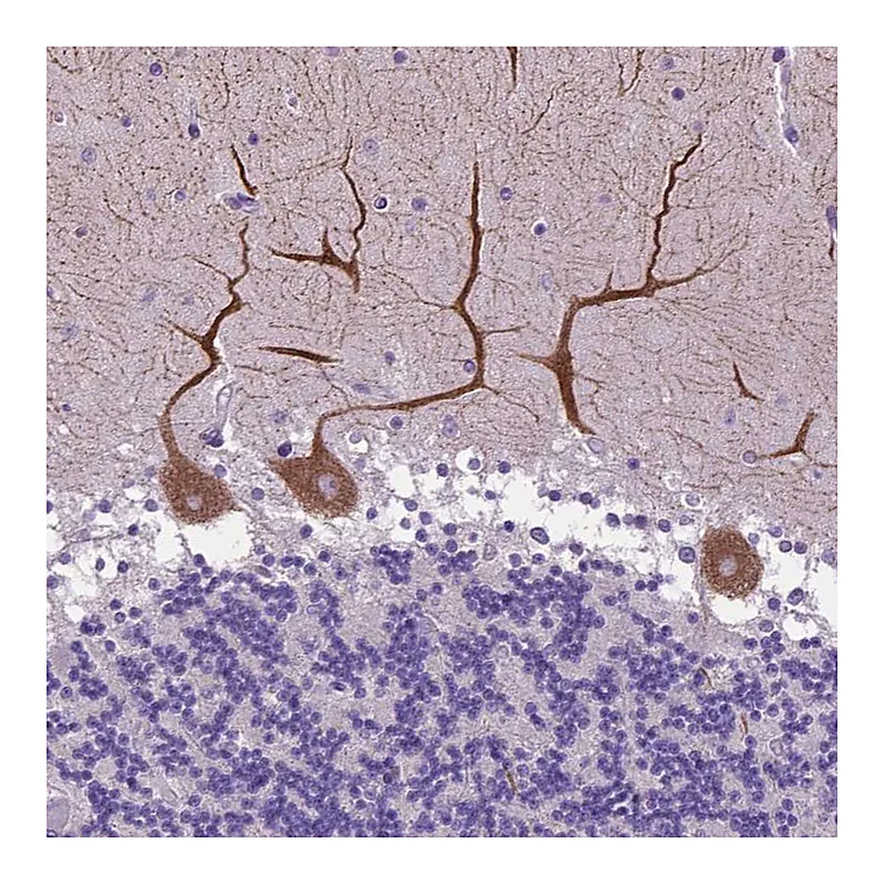 Atlas Antibodies Anti-ADRA2B Antibody