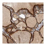 Atlas Antibodies Anti-ADPRM Antibody